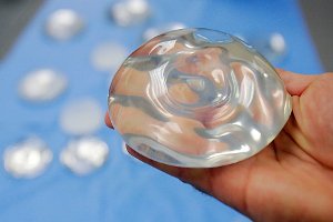 Здравоохранение США одобрило новые силиконовые имплантанты для груди